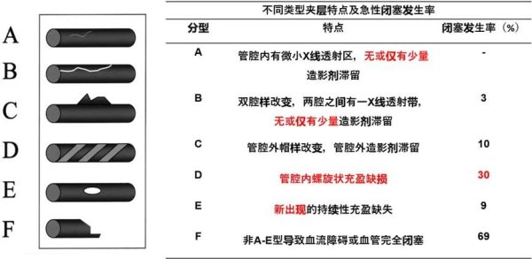 股天下 这4个冠脉造影常见问题，你都会处理了吗？